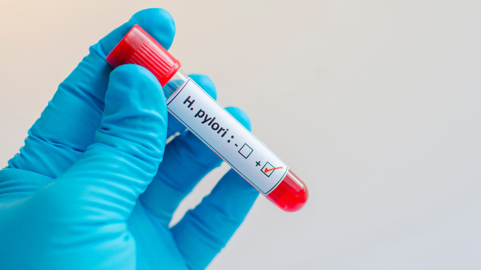 Phương Pháp Hiệu Quả Phát Hiện Helicobacter pylori