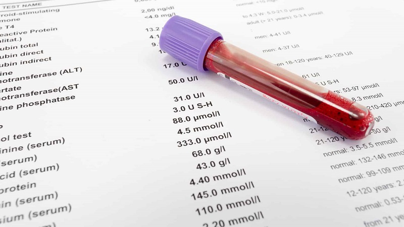 Xét nghiệm Bilirubin và hiểu hơn về tình trạng sức khoẻ cơ thể