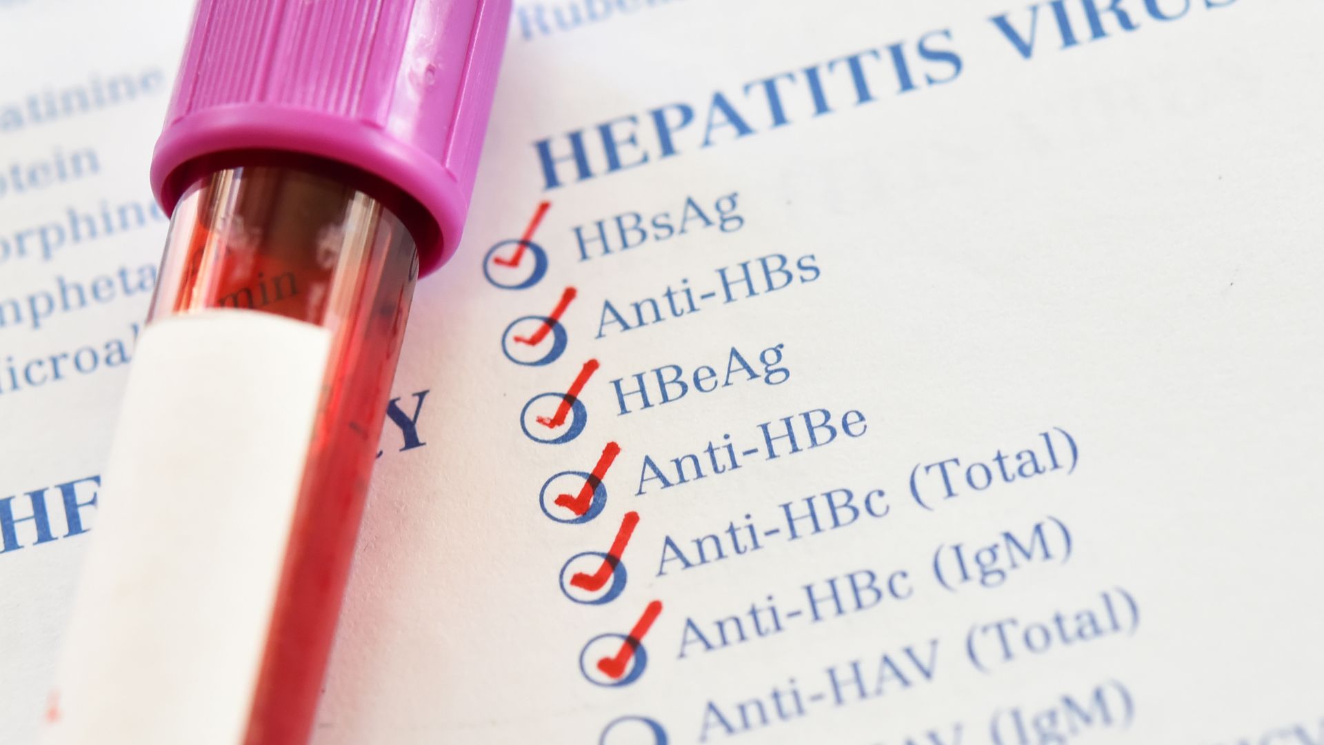 Ống máu trên phiếu chỉ định có đánh dấu các xét nghiệm viêm gan virus HBsAg, Anti-HBs, HBeAg, Anti-HBe, Anti-HBc