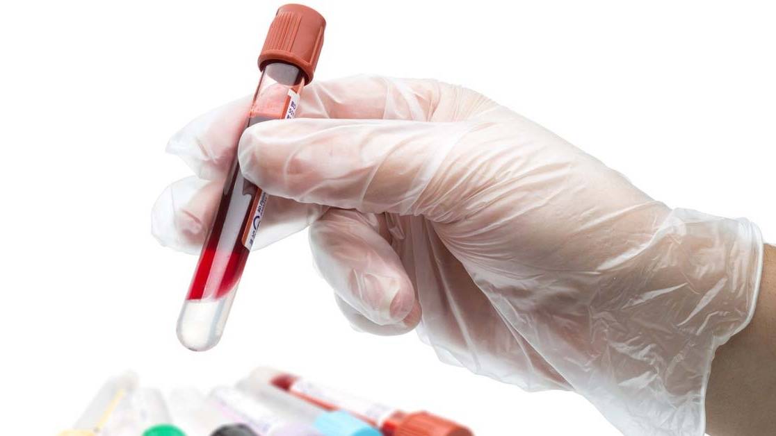 Chỉ số xét nghiệm WBC cao có nguy hiểm không?