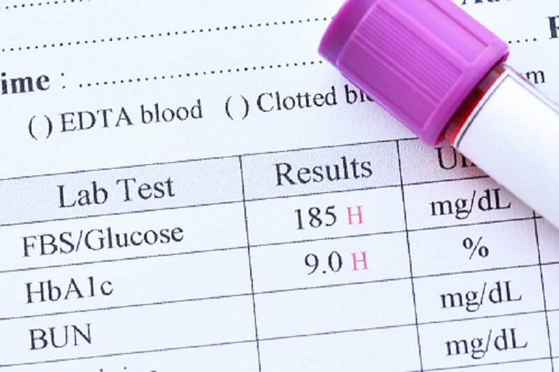Ống máu đặt trên phiếu kết quả có glucose lúc đói 185 mg/dL và HbA1c 9,0% tăng cao