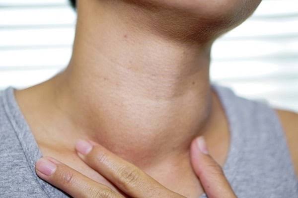 BỆNH BASEDOW VÀ NHỮNG ĐIỀU CẦN BIẾT?