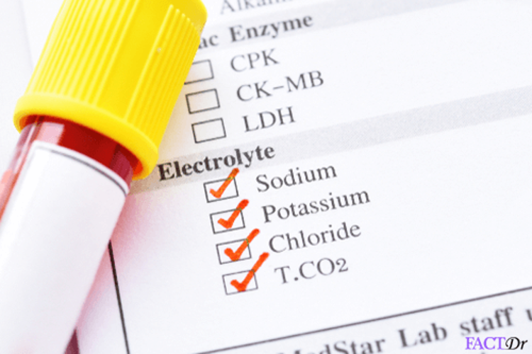 Ống máu trên phiếu chỉ định có đánh dấu xét nghiệm điện giải natri, kali, clo và CO2 toàn phần