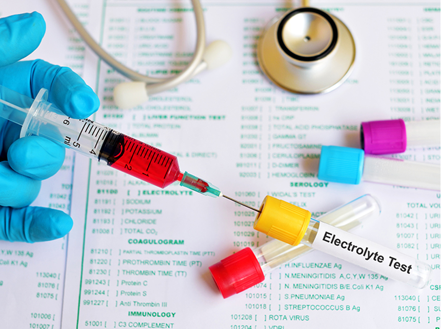 Bơm tiêm máu cạnh ống nghiệm ghi nhãn "Electrolyte Test" (xét nghiệm điện giải) trên phiếu chỉ định