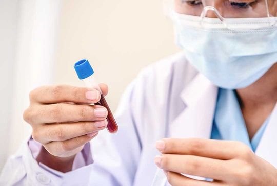 Xét nghiệm CRP là gì? Quy trình và Ý nghĩa các chỉ số