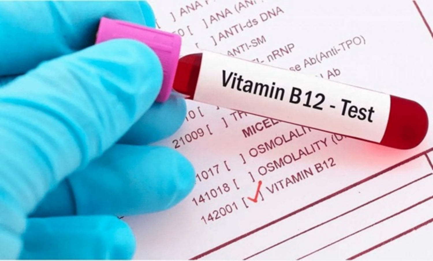Vai trò thực sự cần thiết của Vitamin B12 mà bạn cần biết?