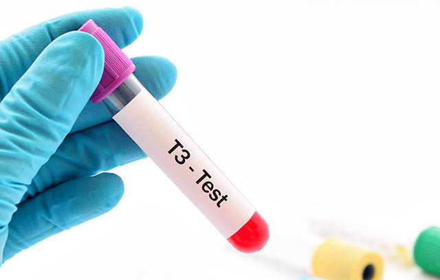 Những điều cần biết về nồng độ hormone tuyến giáp T3
