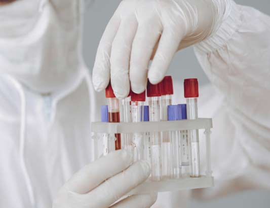 Ý nghĩa của chỉ số CT trong kết quả xét nghiệm RT-PCR?